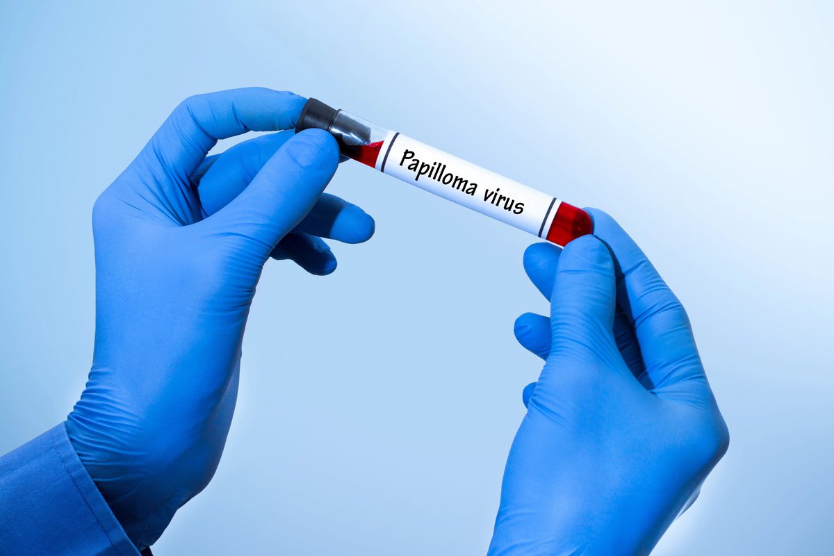 test na wirusa HPV