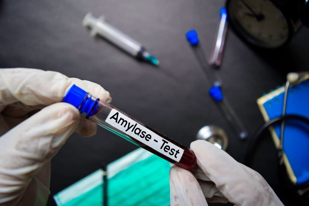 Amylaza we krwi – co oznacza wysoka i niska w morfologii?