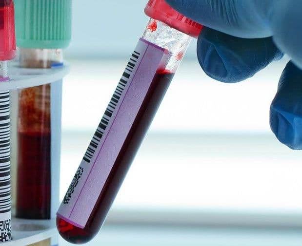 Badanie krwi na pasożyty – diagnostyka pasożytów w organizmie z krwi