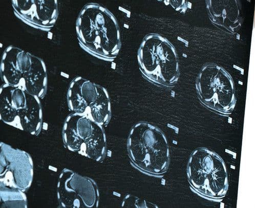 Badania, diagnostyka i markery na raka żołądka