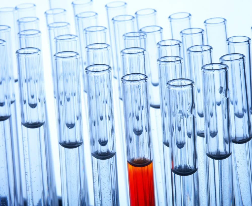 Hemoglobina glikowana HbA1c – norma, badanie, wynik, interpretacja