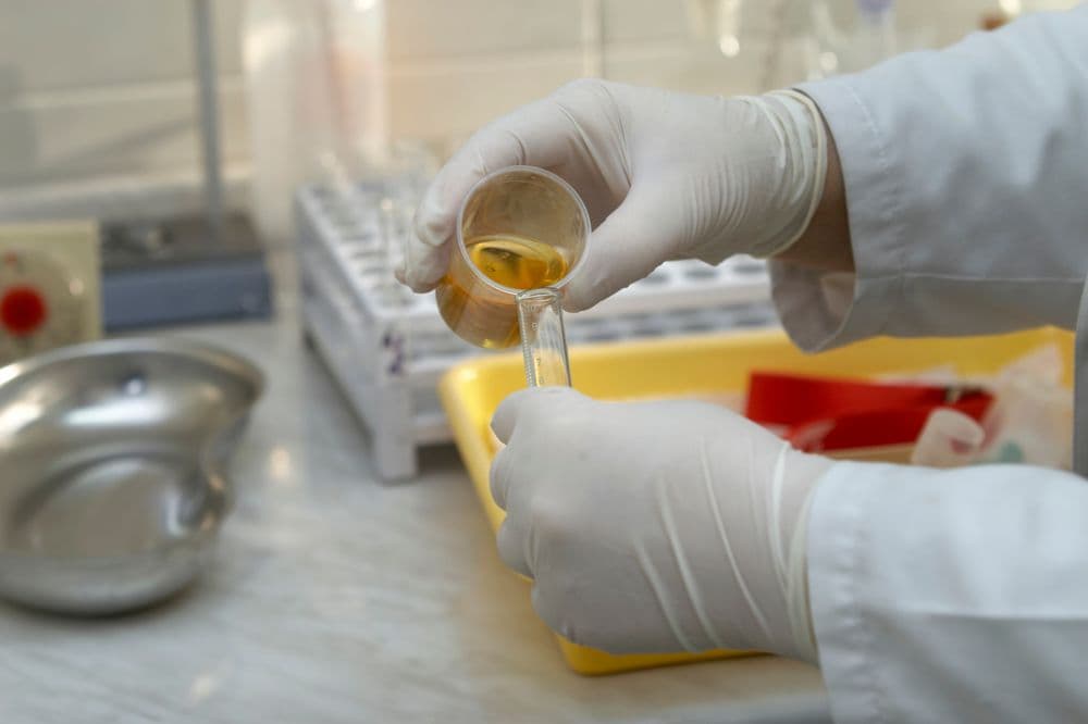 Erytrocyty w moczu – co oznaczają czerwone krwinki w moczu?