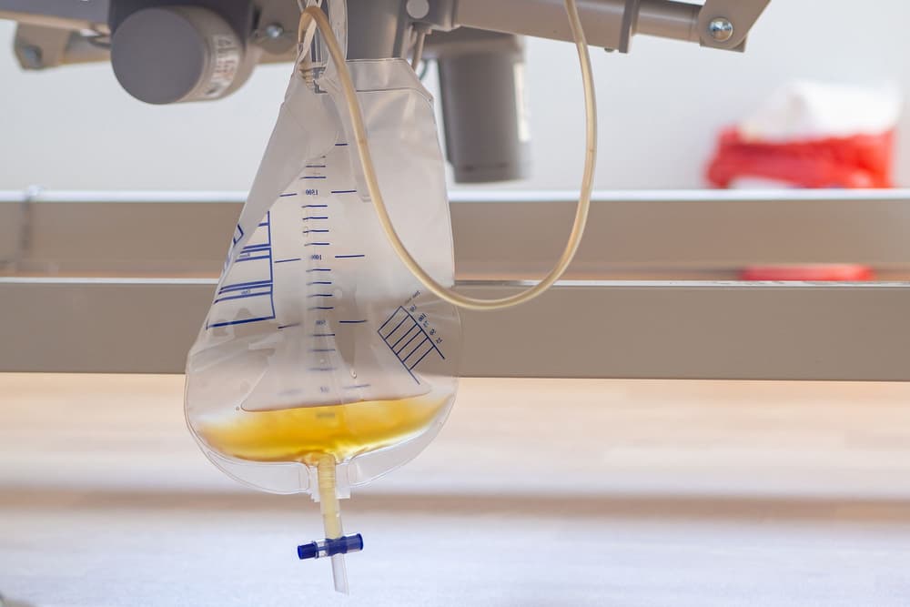 Cewnik urologiczny – co to jest, czy zakładanie boli, jak długo można nosić?