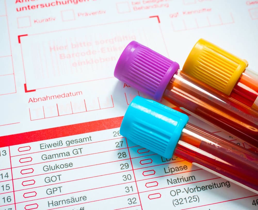 Cholesterol i hiperlipidemie