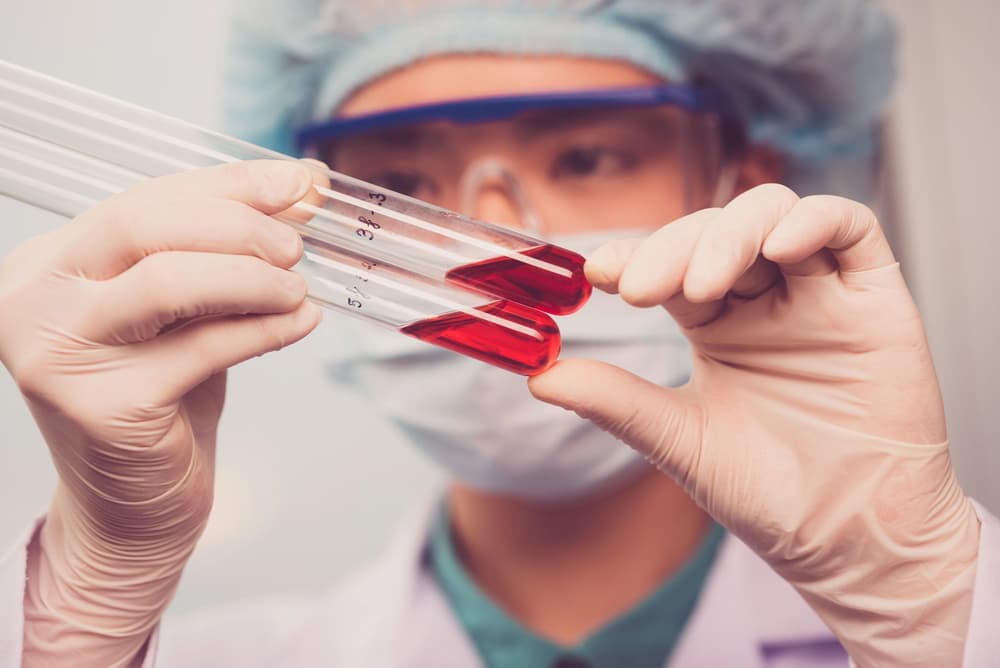 Ebola – co to? Przyczyny, objawy, leczenie, rokowania, szczepienie na wirusa Ebola
