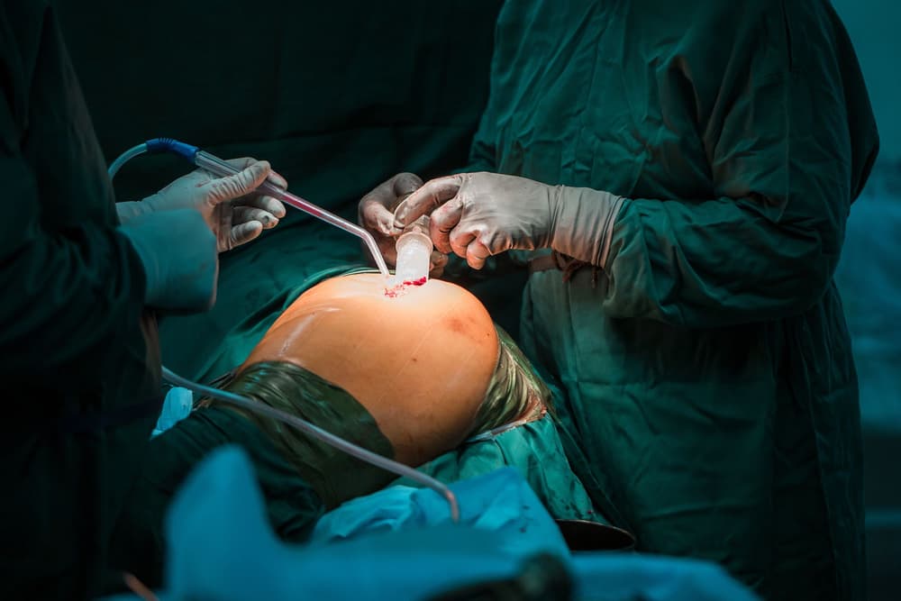 Endoproteza stawu biodrowego – na czym polega? Kiedy się ją stosuje?