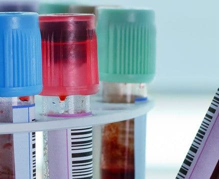 Enolaza – neuroswoista enolaza NSE
