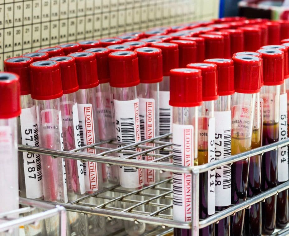Erytropoetyna (EPO) – co to jest, niski poziom, niedobór – jakie są przyczyny?