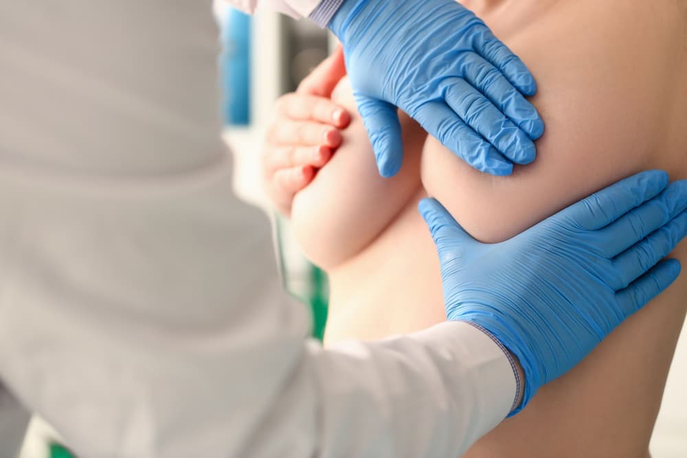 Fibroadenoma – co to jest? Przyczyny, objawy, diagnostyka, leczenie, rokowania, czy usuwać?