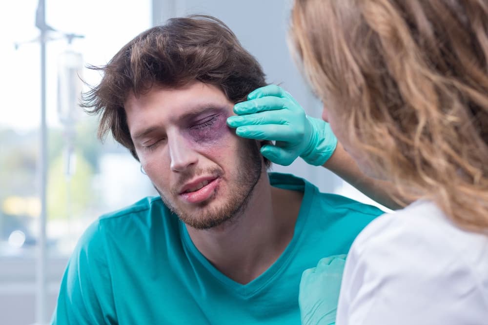 Krwiak okularowy (oczy szopa) – przyczyny, jak wygląda, jak długo się utrzymuje, leczenie