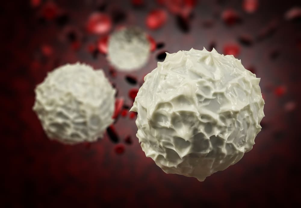 Leukocytoza (podwyższone i wysokie leukocyty) – jakie są przyczyny i leczenie?
