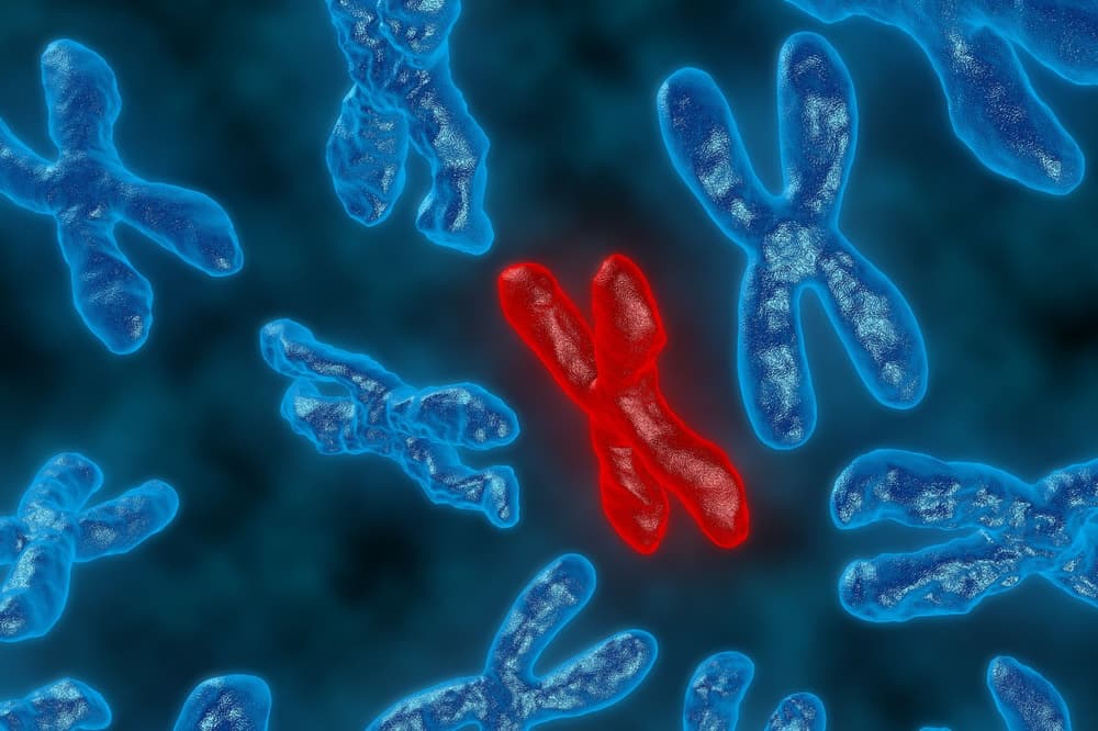 Zespół łamliwego chromosomu X