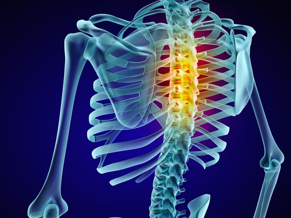 Osteofity kręgosłupa (osteofitoza) – przyczyny, objawy i leczenie osteofitów na kręgosłupie