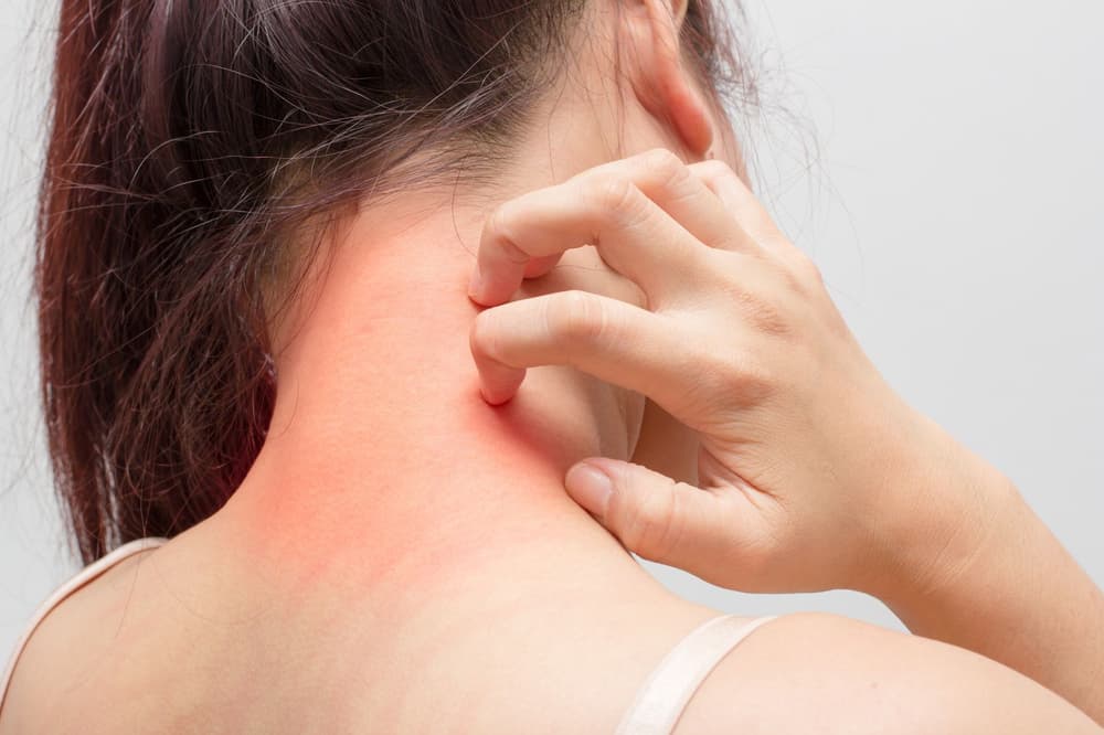 Dermatillomania – co to jest, przyczyny, objawy, leczenie