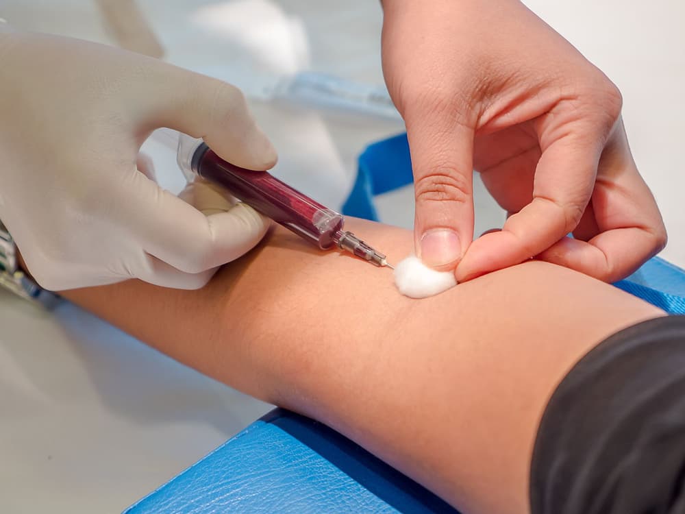 Hipoalbuminemia – co oznaczają niskie albuminy we krwi?
