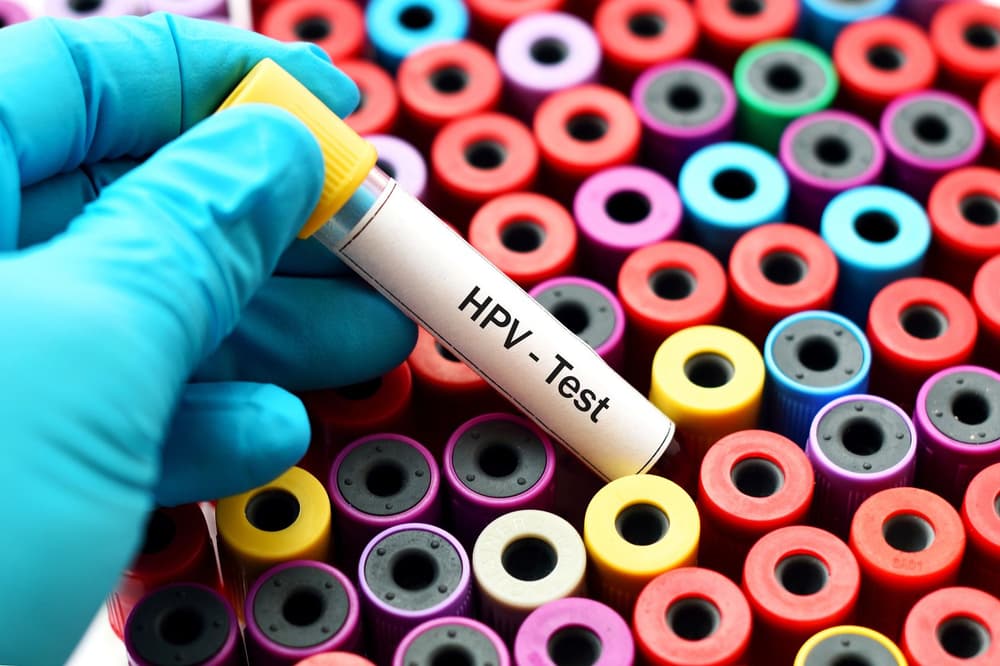 Szczepionka przeciw wirusowi HPV – szczepić czy nie, skutki uboczne, powikłania, cena, opinie