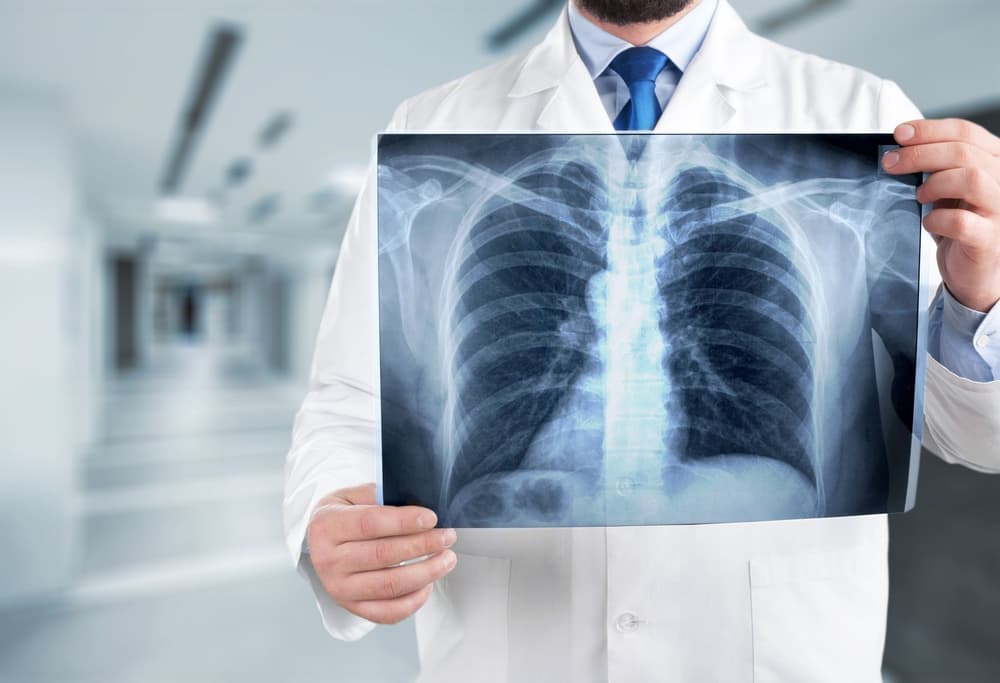 Śródmiąższowe zapalenie płuc – przyczyny, objawy, diagnostyka, leczenie
