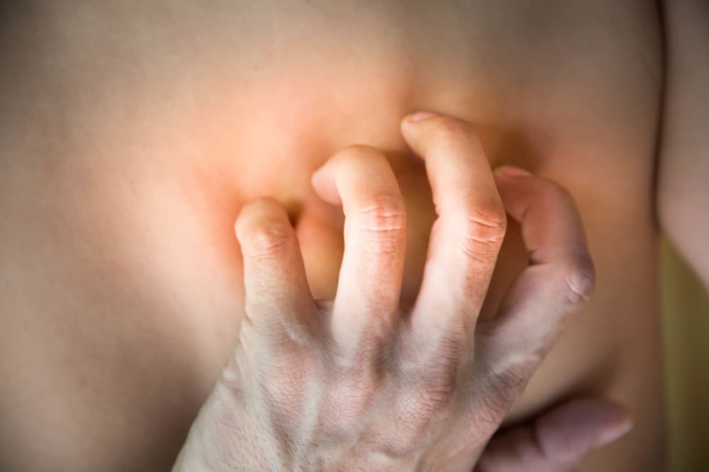 Pęcherzyca – czy jest zaraźliwa, jakie są przyczyny, objawy i leczenie?