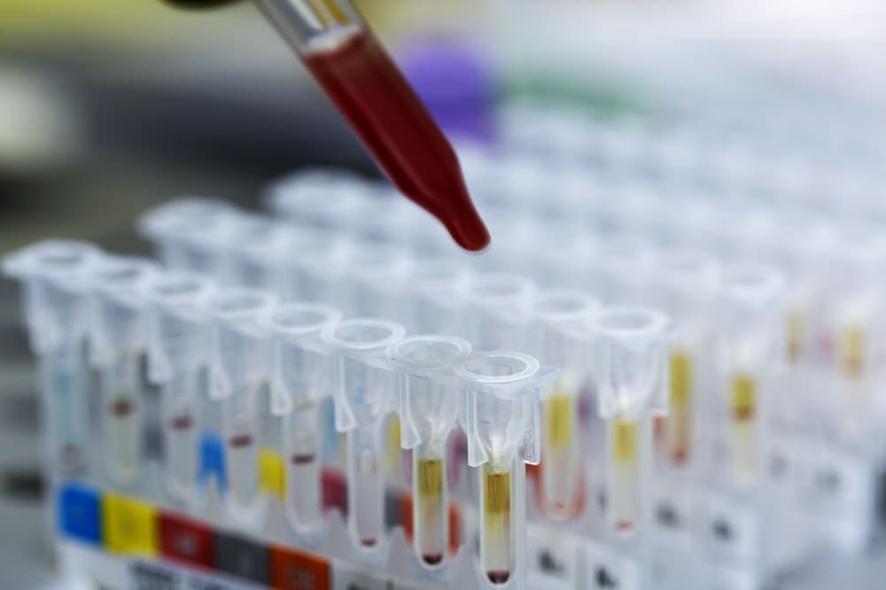 Próba tuberkulinowa (test) – jak odczytać wynik odczynu?