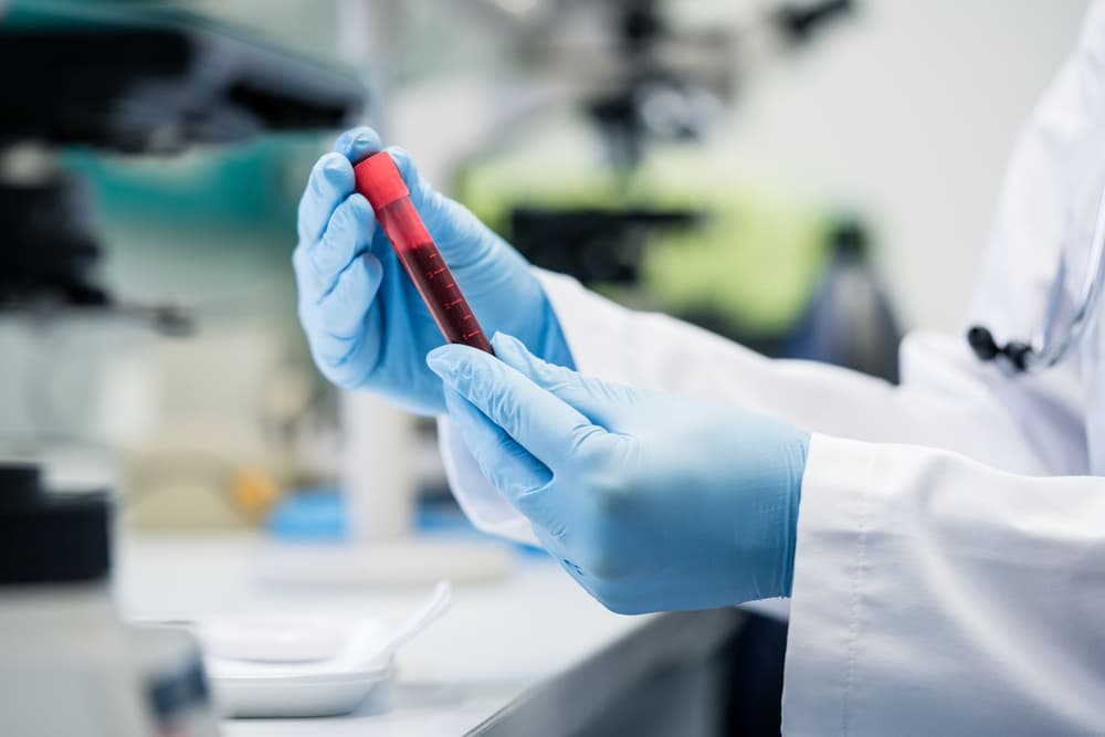 MCHC morfologia – co to jest, poniżej normy, podwyższone, w ciąży, u dziecka