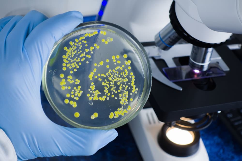 Escherichia coli – objawy i leczenie zakżenia bakterią