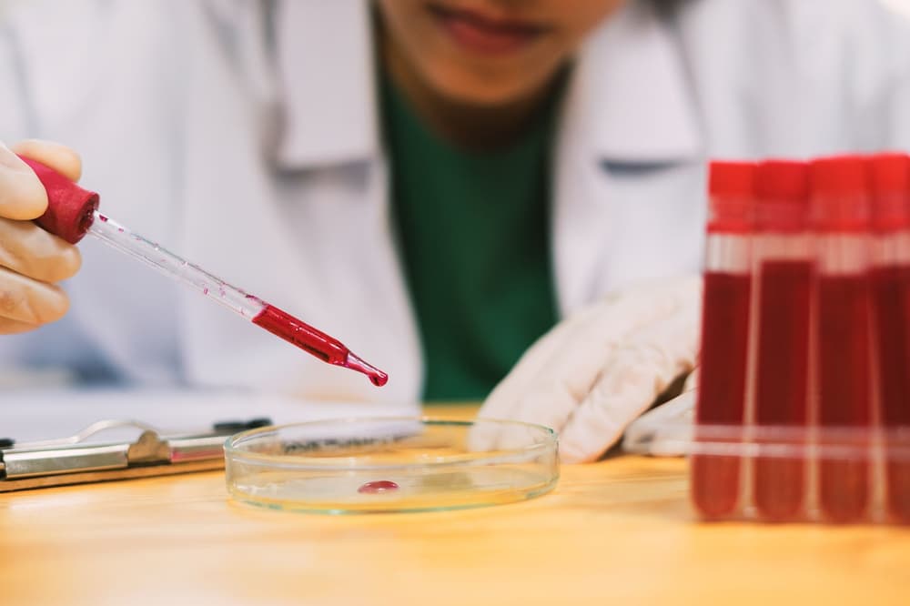 Neutrofile – co oznaczają podwyższone, a co neutrofile poniżej normy?