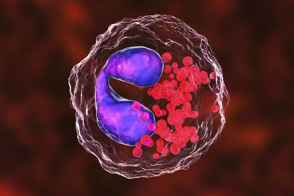 Neutropenia – przyczyny, objawy, leczenie