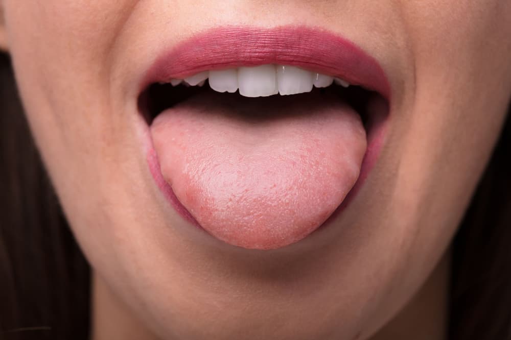 Popękany język – co oznaczają bruzdy na języku?