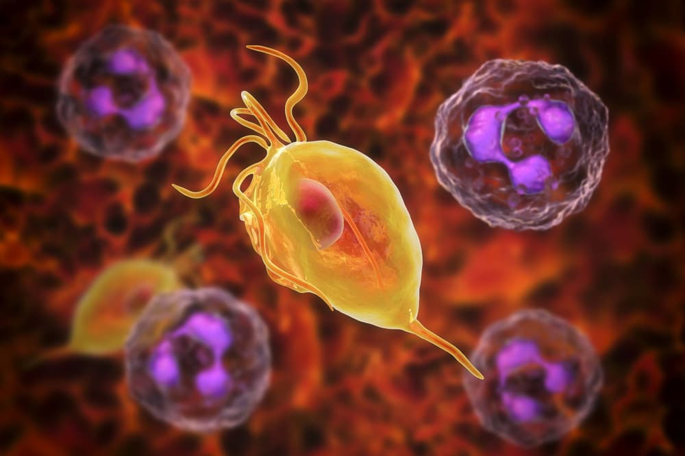 Rzęsistkowica – przyczyny, objawy, diagnostyka, leczenie, powikłania