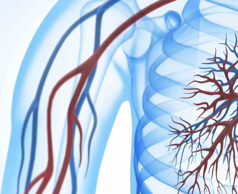 Guzkowe zapalenie tętnic (choroba Kussmaula)