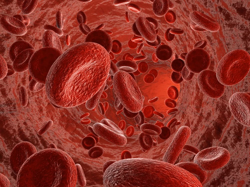 Wysoki poziom hemoglobiny (hemoglobinemia) – objawy, przyczyny, leczenie