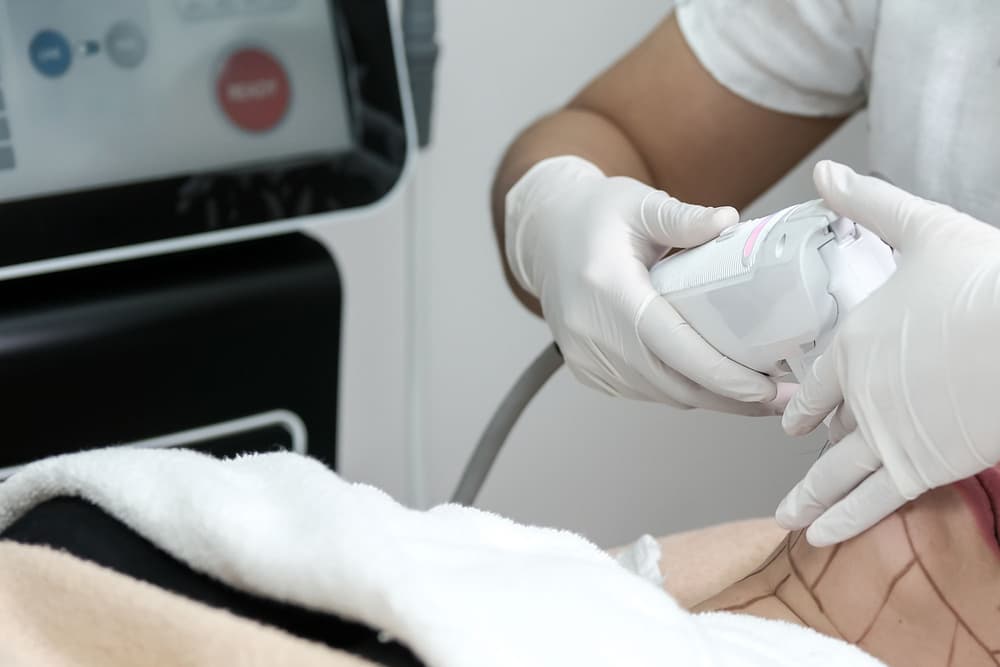 Echoterapia guzów tarczycy (HIFU) – kwalifikacja do zabiegu, przebieg zabiegu, efekty, skutki uboczne