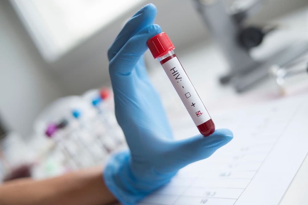 Test na HIV – co warto wiedzieć?