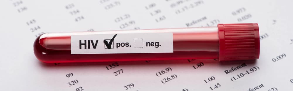 HIV – najważniejsze informacje w pigułce