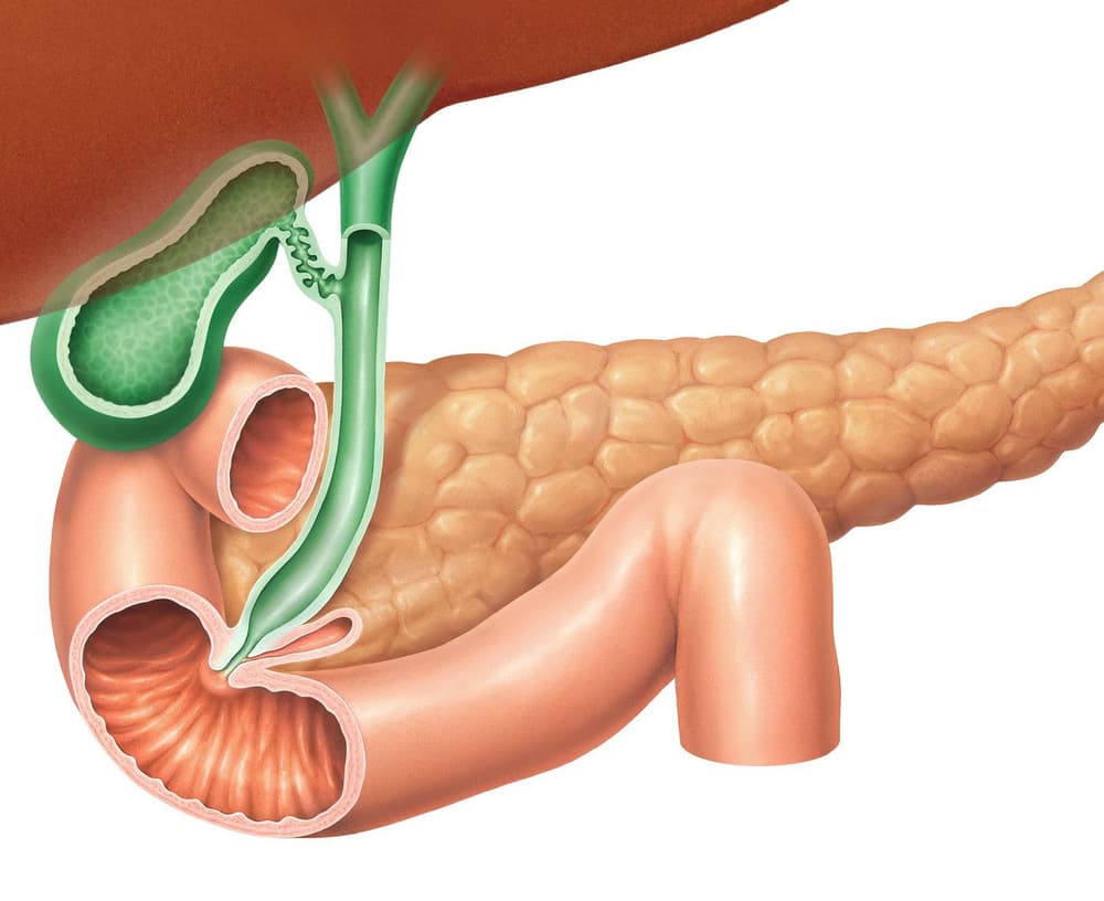 Insulinoma (wyspiak trzustki) – objawy, badania, leczenie, rokowania