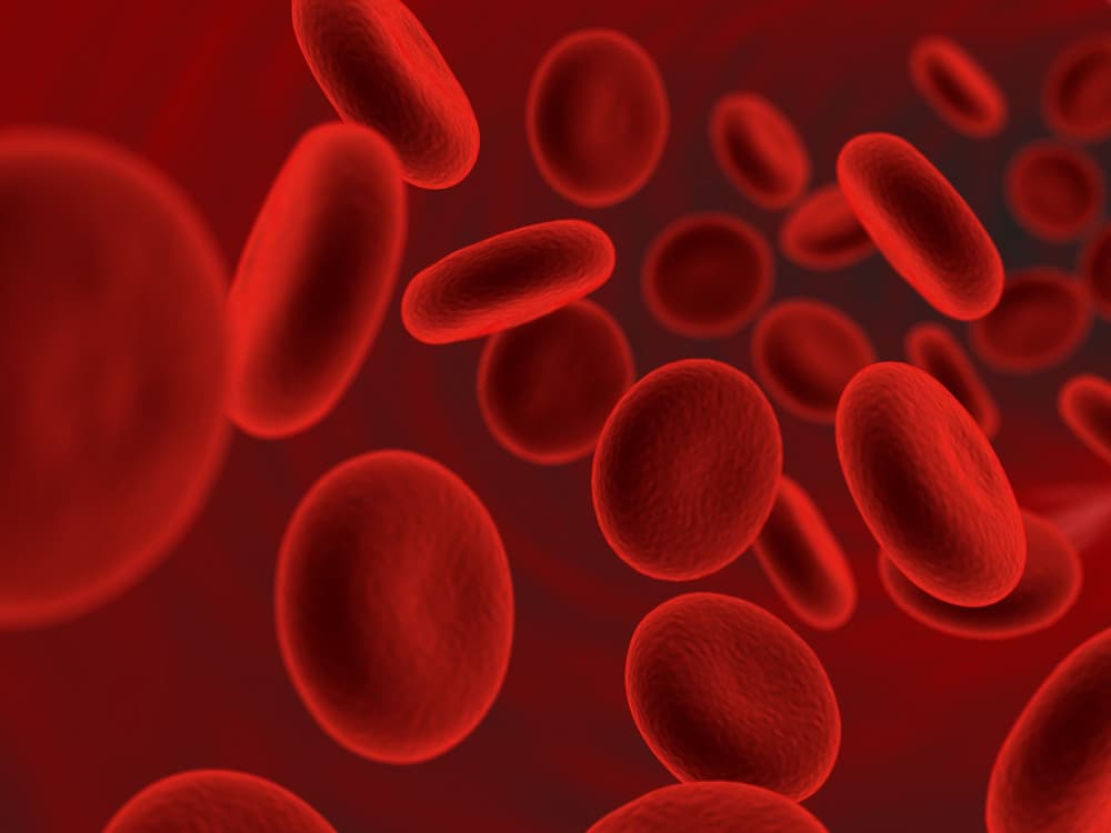 Hemofilia – co to? Rodzaje, przyczyny, objawy, diagnostyka, leczenie, dziedziczenie