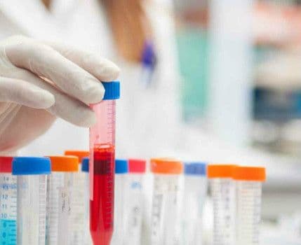 Niedokrwistość autoimmunohemolityczna – czym jest, rodzaje, objawy, leczenie
