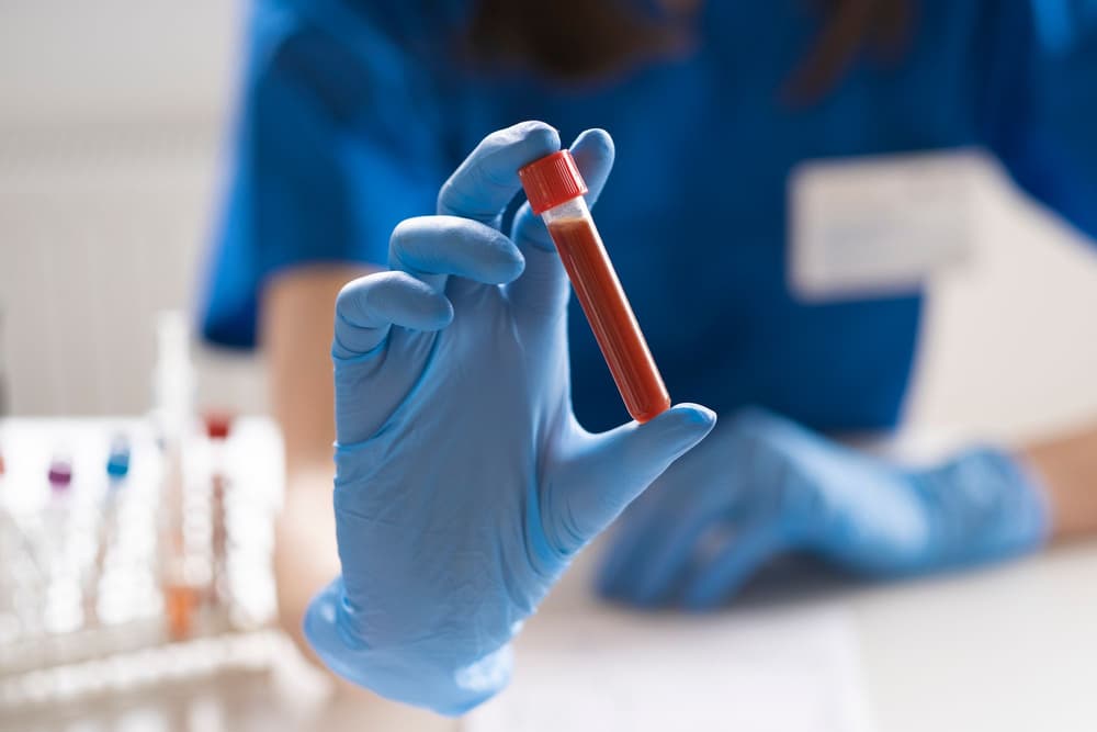 Gazometria – na czym polega?