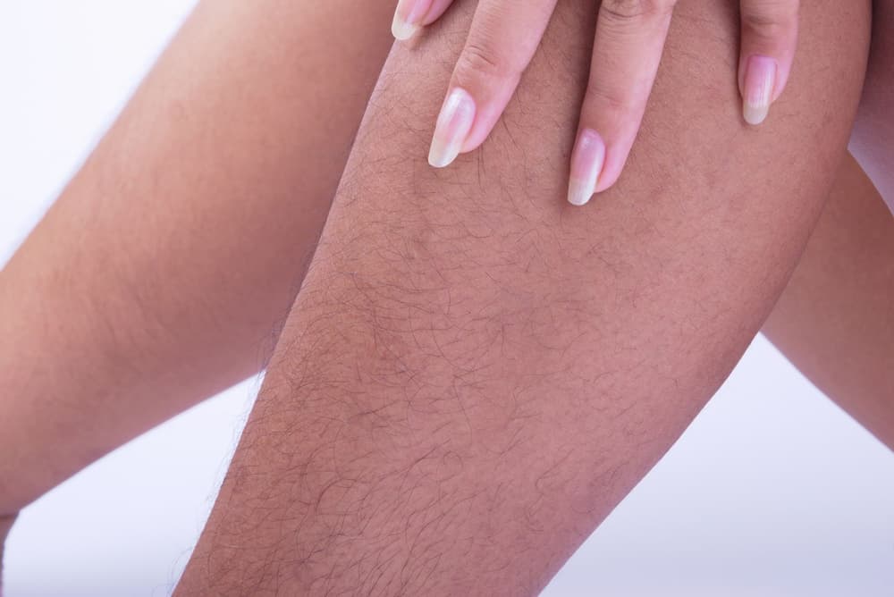 Co to jest hiperandrogenizm? Jakie daje objawy i jak leczyć nadmiar androgenów u kobiet?