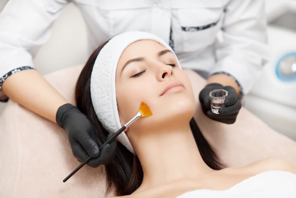 Peeling chemiczny – rodzaje, wskazania, efekty, cena