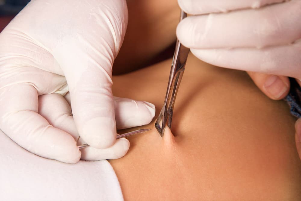 Kolczykowanie ciała (piercing) – co to jest? Rodzaje piercingu, bezpieczeństwo, infekcje