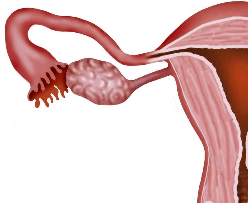 Polip endometrialny – przyczyny, objawy, badania, leczenie