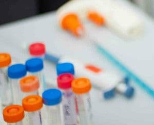 Przeciwciała anty-HBc – czym są, kiedy bada się ich poziom, co oznacza wynik?