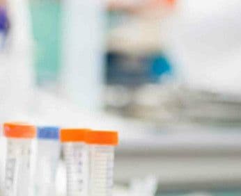 Przeciwciała IgG przeciw różyczce anty-Rubella IgG