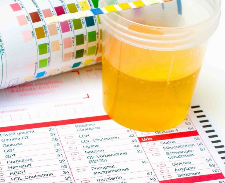 Skąpomocz i bezmocz – przyczyny, objawy, diagnostyka, leczenie