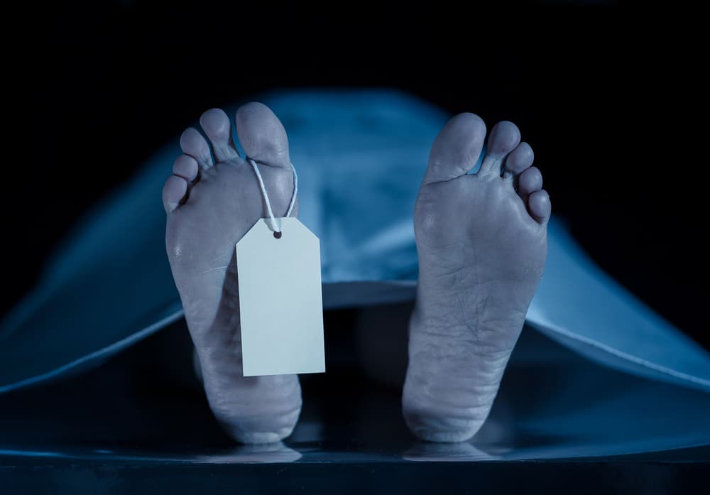 Stężenie pośmiertne (rigor mortis) – co to jest, jak wygląda i kiedy występuje?