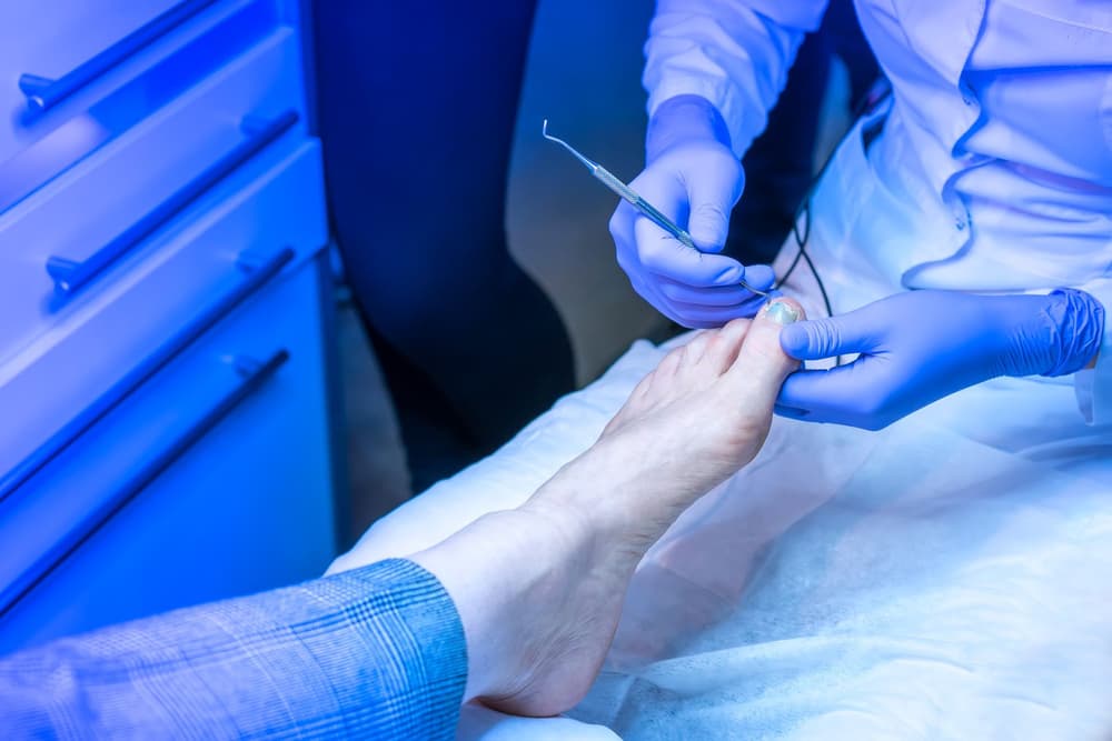 Tamponada paznokcia – instrukcja – jak zrobić samemu w domu, gdzie kupić?