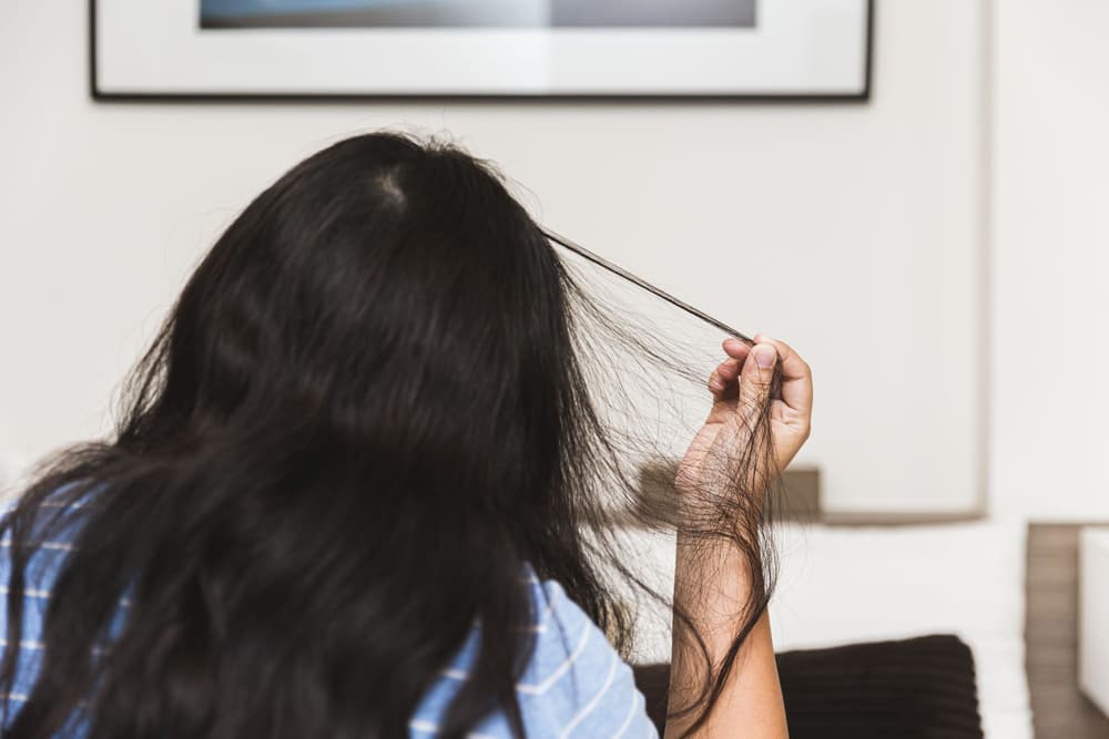 Trichotillomania – co to? Przyczyny, objawy, leczenie