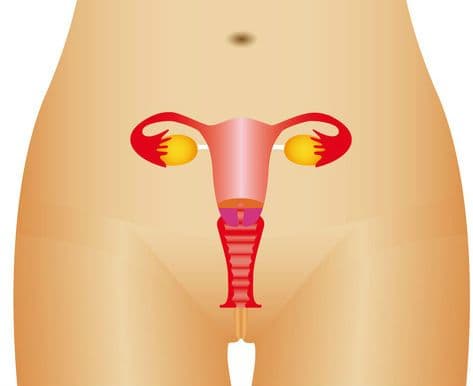 Wady anatomiczne pochwy i macicy