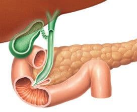 Woreczek żółciowy – jak żyć z kamieniami w woreczku, kiedy go usunąć i jaką dietę stosować?